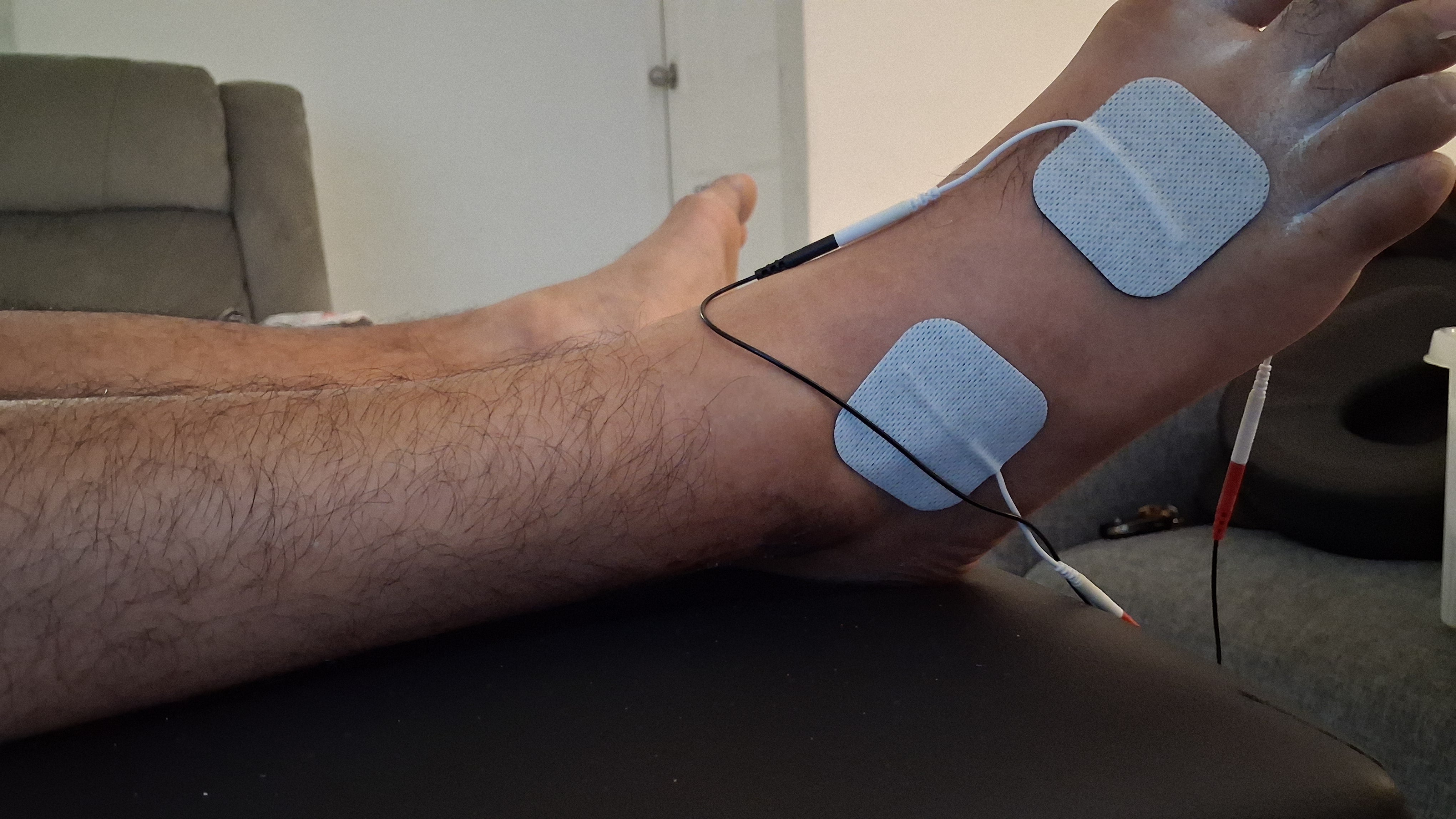 Sesion de electroterapia
